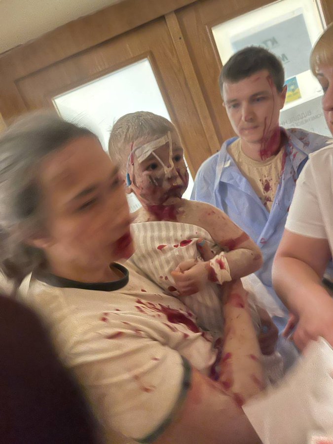 Hôpital pour enfants « Okhmatdyt » à Kiev. L’un des plus importants non seulement en Ukraine, mais aussi en Europe, exclusivement un hôpital pour enfants. « Okhmatdit » a sauvé et restauré la santé de milliers d’enfants.